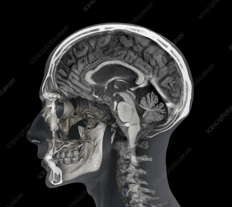 MRI Scan Visualization